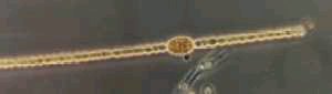 Anabaena