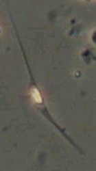 Bitrichia chodatii
