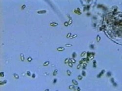Chlamydomonas