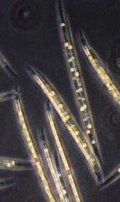 Closterium