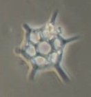 Dictyocha speculum