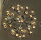 Dictyosphaerium