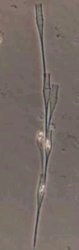 Dinobryon bavaricum