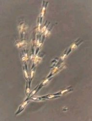 Dinobryon divergens