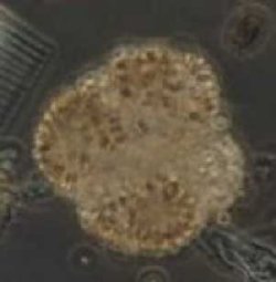 Gomphosphaeria