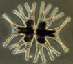 Micrasterias