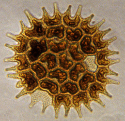 Pediastrum