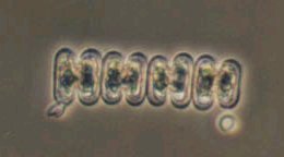 Spondylosium