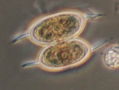 Staurodesmus