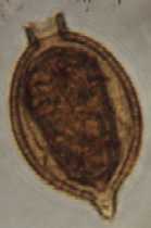 Trachelomonas