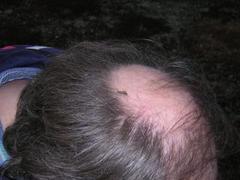 Mosquito (Culicidae)
