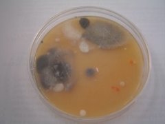 Gjærsopp (Saccharomycetales)