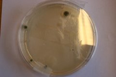 Aspergillus
