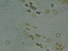 Gullalger (Chrysophyceae)