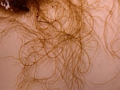 Cat gut (Chorda filum)