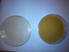 Aspergillus