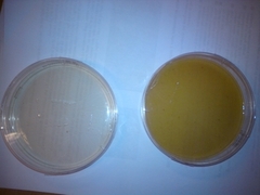 Aspergillus