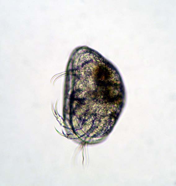 035F Ostracoda- Musselkrafta 001