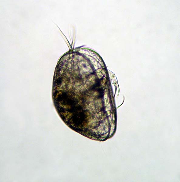 035F Ostracoda- Musselkrafta 002