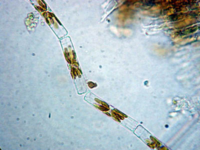 Diatoms_3