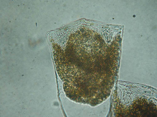 Protist, ciliates